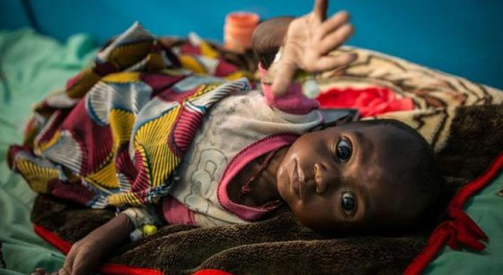 200,000 children at risk of starvation in Mali, warn UN agencies